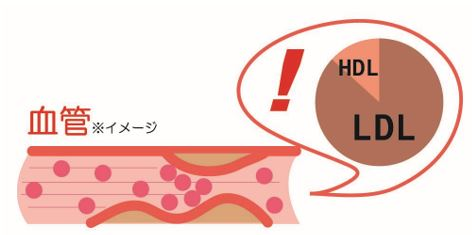 LDLコレステロールのイメージ